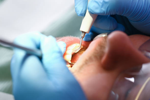 Best Chipped Tooth Repair Near Me  in Brunswick, GA