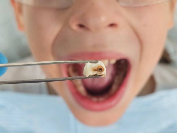 Best Emergency Tooth Extraction  in Brunswick, GA