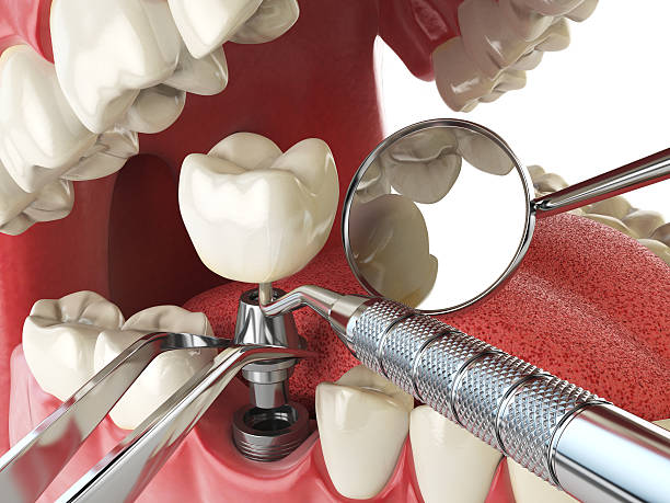 Best Emergency Tooth Extraction  in Brunswick, GA